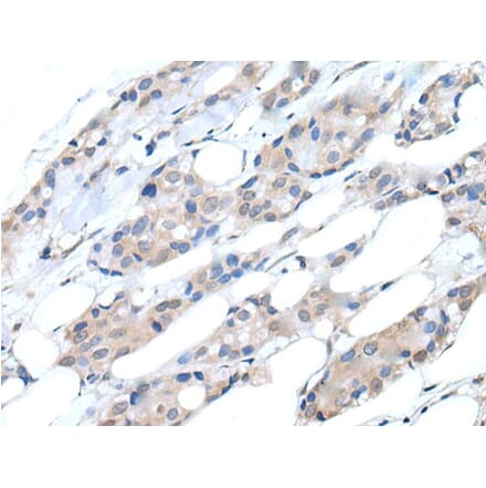 PIK3CA Antibody from Signalway Antibody (43766) - Antibodies.com