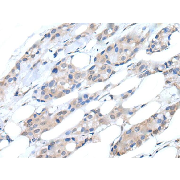 PIK3CA Antibody from Signalway Antibody (43766) - Antibodies.com