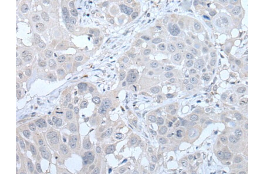 PIK3CA Antibody from Signalway Antibody (43766) - Antibodies.com