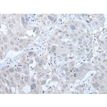 PIK3CA Antibody from Signalway Antibody (43766) - Antibodies.com