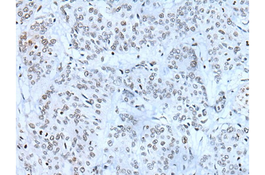 ZBTB11 Antibody from Signalway Antibody (43783) - Antibodies.com