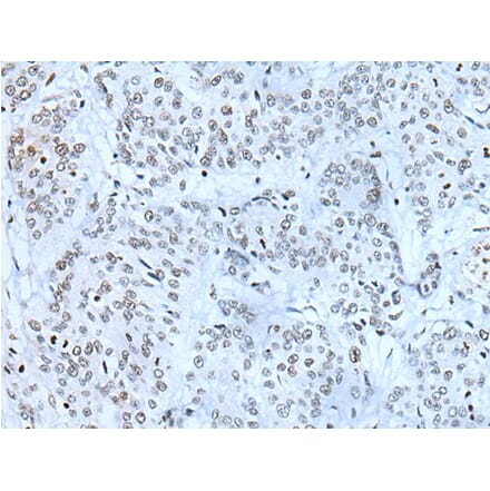 ZBTB11 Antibody from Signalway Antibody (43783) - Antibodies.com
