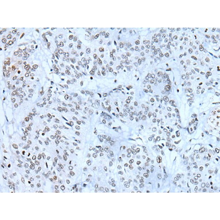 ZBTB11 Antibody from Signalway Antibody (43783) - Antibodies.com