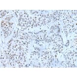 ZBTB11 Antibody from Signalway Antibody (43783) - Antibodies.com