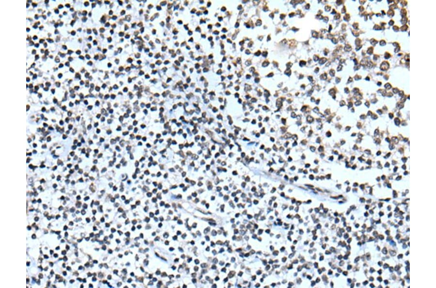 ZBTB11 Antibody from Signalway Antibody (43783) - Antibodies.com