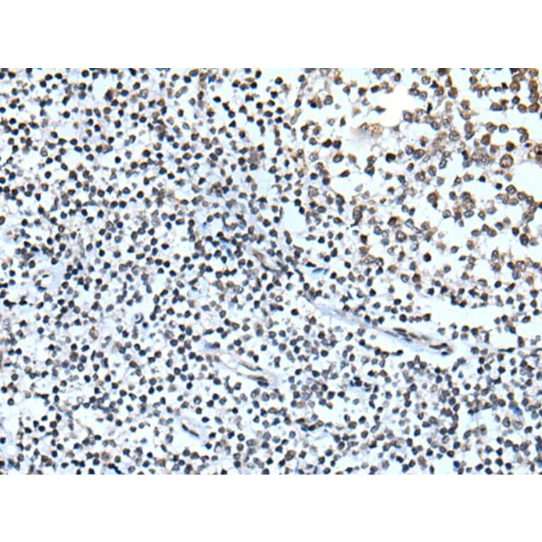 ZBTB11 Antibody from Signalway Antibody (43783) - Antibodies.com