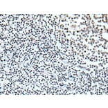 ZBTB11 Antibody from Signalway Antibody (43783) - Antibodies.com
