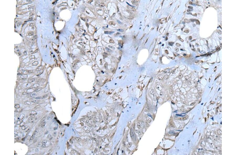 ZNF703 Antibody from Signalway Antibody (43788) - Antibodies.com