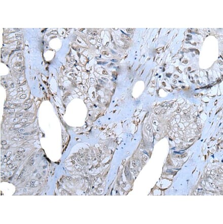 ZNF703 Antibody from Signalway Antibody (43788) - Antibodies.com