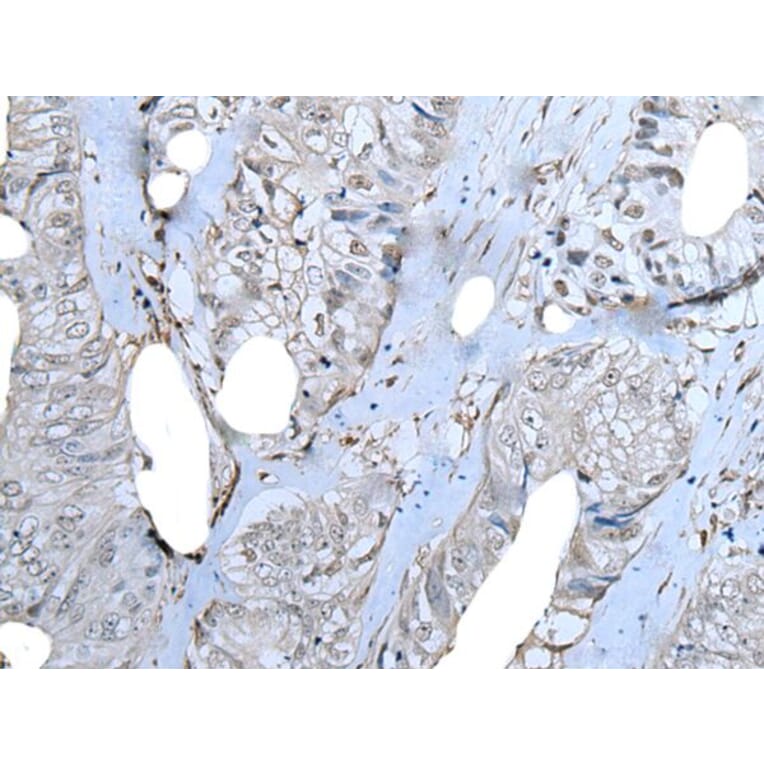 ZNF703 Antibody from Signalway Antibody (43788) - Antibodies.com