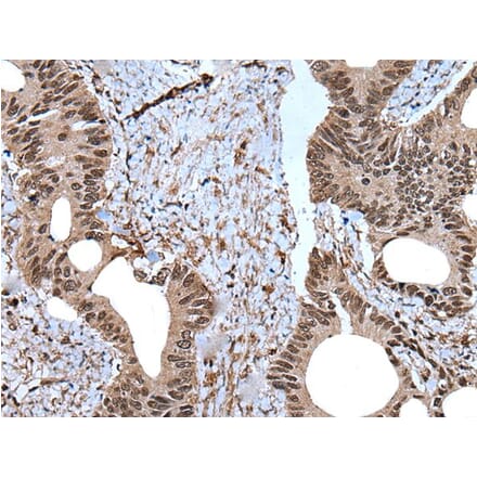 ZNF787 Antibody from Signalway Antibody (43790) - Antibodies.com