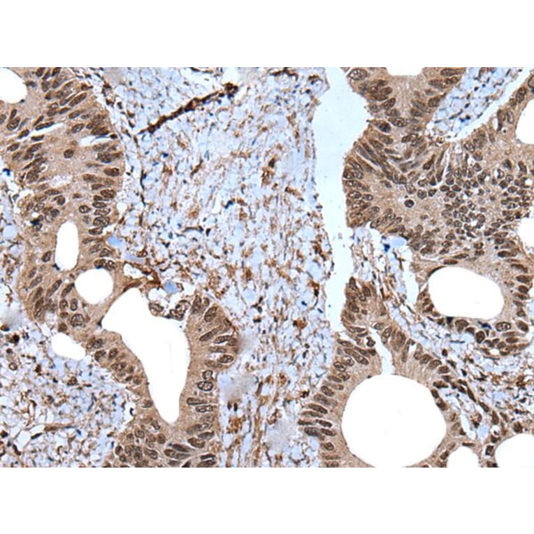 ZNF787 Antibody from Signalway Antibody (43790) - Antibodies.com