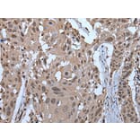 ZNF787 Antibody from Signalway Antibody (43790) - Antibodies.com
