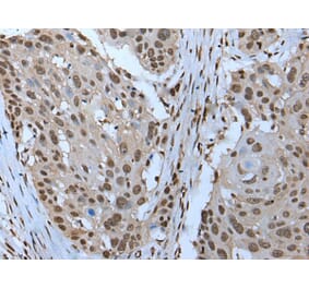 ZNHIT3 Antibody from Signalway Antibody (43791) - Antibodies.com