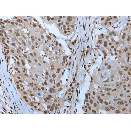 ZNHIT3 Antibody from Signalway Antibody (43791) - Antibodies.com