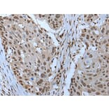 ZNHIT3 Antibody from Signalway Antibody (43791) - Antibodies.com