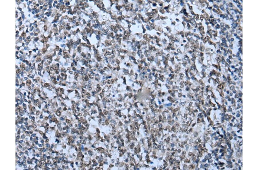 ZNHIT3 Antibody from Signalway Antibody (43791) - Antibodies.com