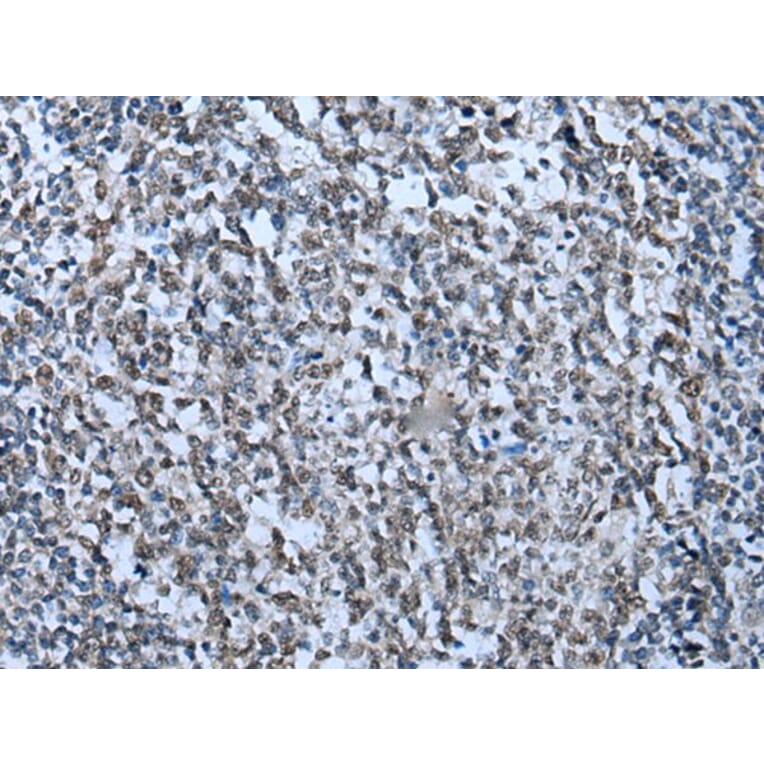 ZNHIT3 Antibody from Signalway Antibody (43791) - Antibodies.com