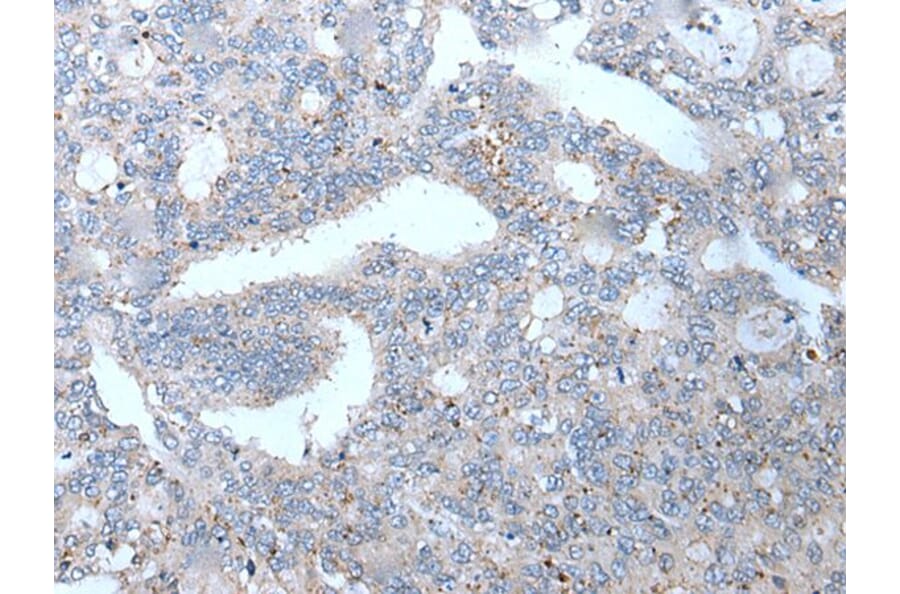 WFDC12 Antibody from Signalway Antibody (43809) - Antibodies.com