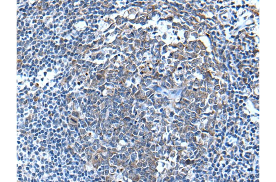 WFDC12 Antibody from Signalway Antibody (43809) - Antibodies.com