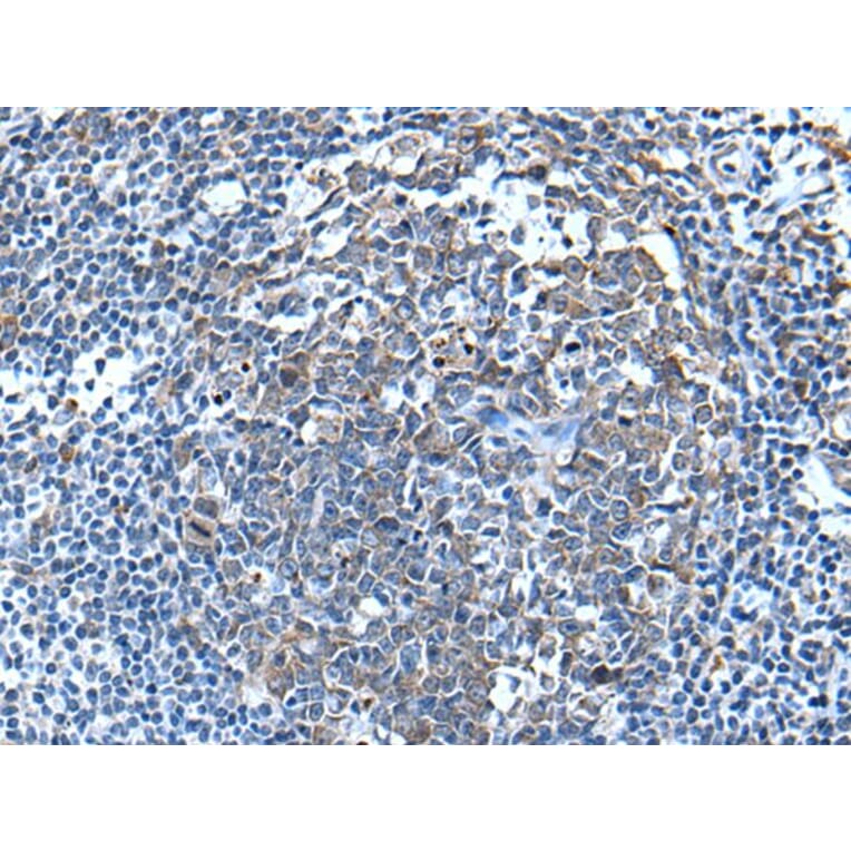 WFDC12 Antibody from Signalway Antibody (43809) - Antibodies.com
