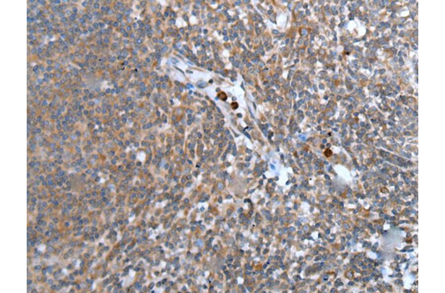 WISP2 Antibody from Signalway Antibody (43815) - Antibodies.com