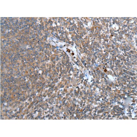 WISP2 Antibody from Signalway Antibody (43815) - Antibodies.com