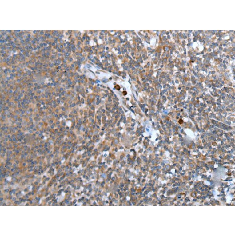 WISP2 Antibody from Signalway Antibody (43815) - Antibodies.com