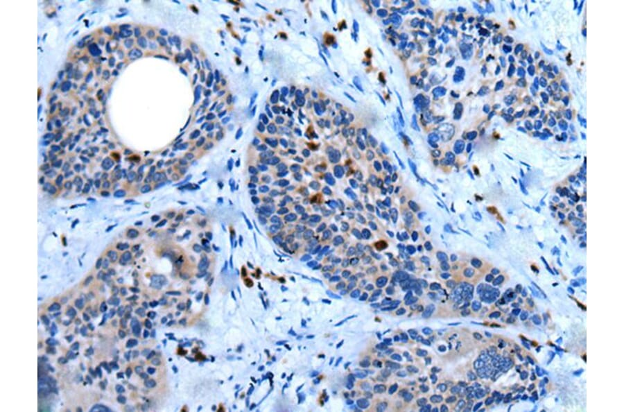 WISP2 Antibody from Signalway Antibody (43815) - Antibodies.com