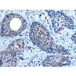 WISP2 Antibody from Signalway Antibody (43815) - Antibodies.com