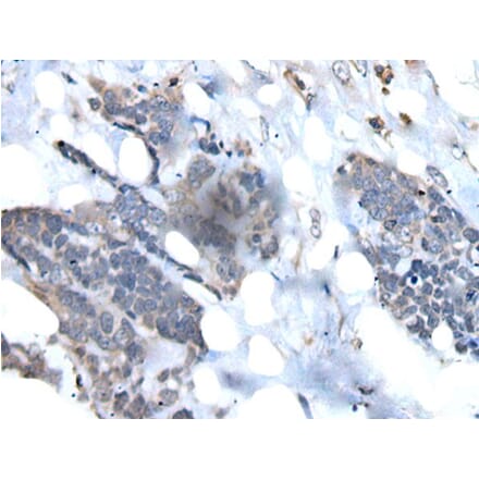 VPREB1 Antibody from Signalway Antibody (43823) - Antibodies.com