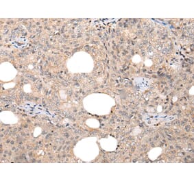 CHAMP1 Antibody from Signalway Antibody (43866) - Antibodies.com