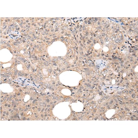 CHAMP1 Antibody from Signalway Antibody (43866) - Antibodies.com