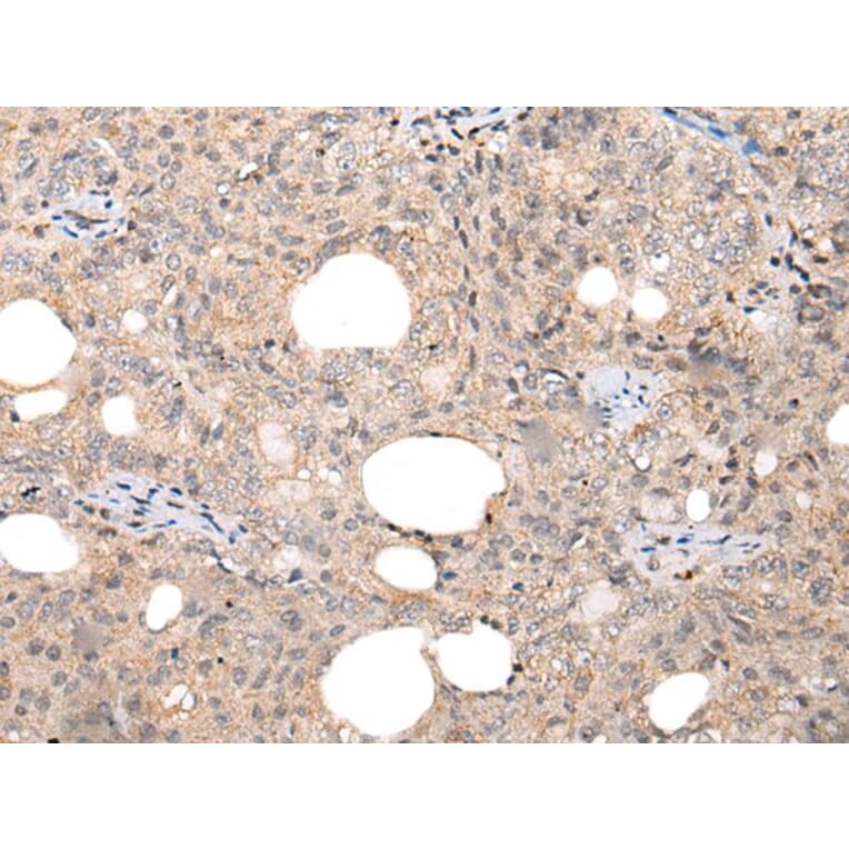 CHAMP1 Antibody from Signalway Antibody (43866) - Antibodies.com