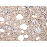 CHAMP1 Antibody from Signalway Antibody (43866) - Antibodies.com