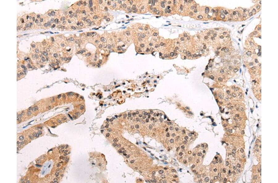 CHAMP1 Antibody from Signalway Antibody (43866) - Antibodies.com