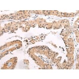 CHAMP1 Antibody from Signalway Antibody (43866) - Antibodies.com