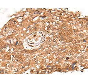 KLHL36 Antibody from Signalway Antibody (43871) - Antibodies.com