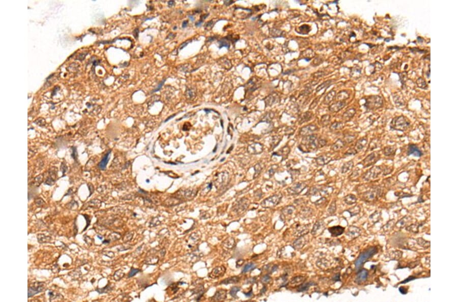 KLHL36 Antibody from Signalway Antibody (43871) - Antibodies.com