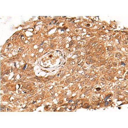 KLHL36 Antibody from Signalway Antibody (43871) - Antibodies.com