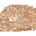 KLHL36 Antibody from Signalway Antibody (43871) - Antibodies.com