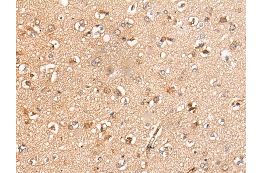 KLHL36 Antibody from Signalway Antibody (43871) - Antibodies.com