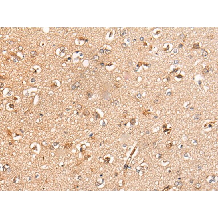 KLHL36 Antibody from Signalway Antibody (43871) - Antibodies.com