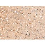 KLHL36 Antibody from Signalway Antibody (43871) - Antibodies.com