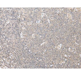 ZFYVE1 Antibody from Signalway Antibody (43888) - Antibodies.com