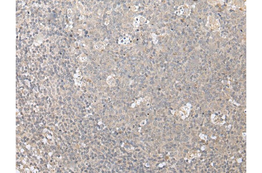 ZFYVE1 Antibody from Signalway Antibody (43888) - Antibodies.com