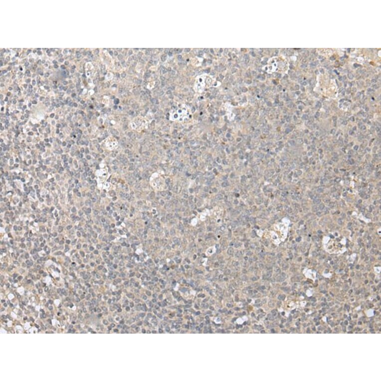 ZFYVE1 Antibody from Signalway Antibody (43888) - Antibodies.com