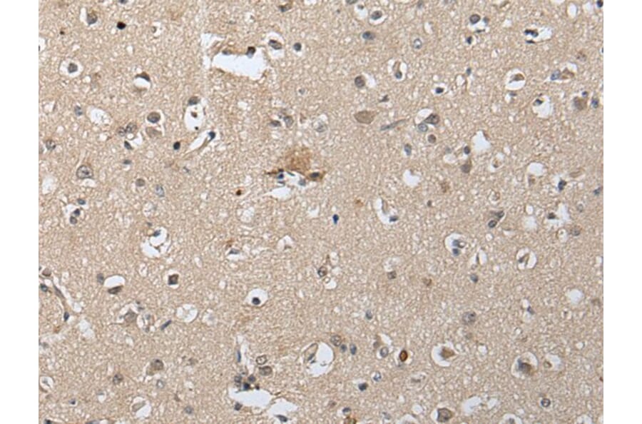 SLC8A1 Antibody from Signalway Antibody (43934) - Antibodies.com