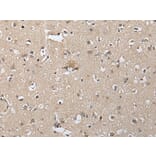 SLC8A1 Antibody from Signalway Antibody (43934) - Antibodies.com