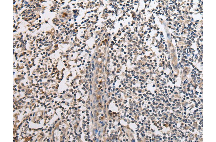 SLC8A1 Antibody from Signalway Antibody (43934) - Antibodies.com